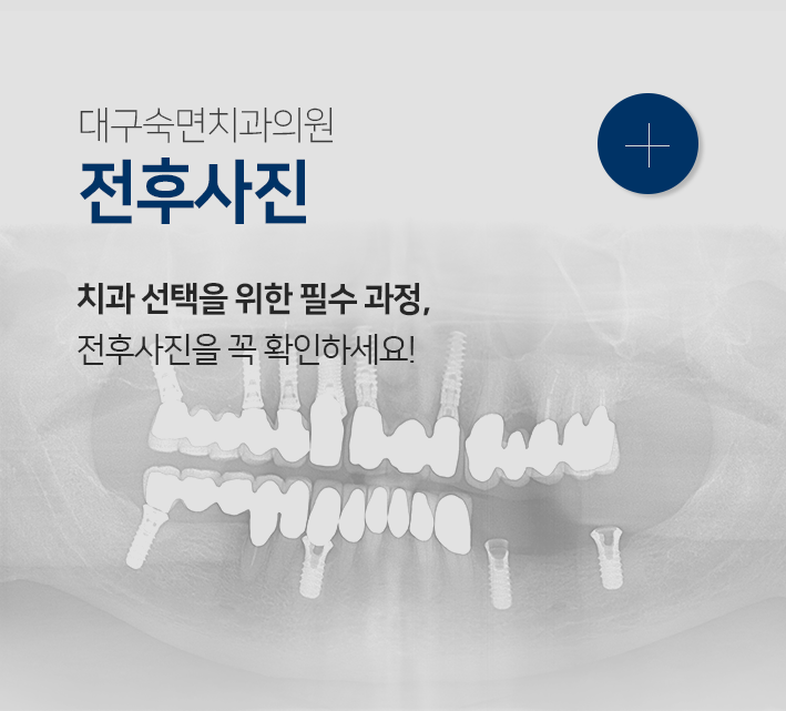 전후사진-치과-선택을-위한-필수-과정-전후사진을-꼭-확인하세요