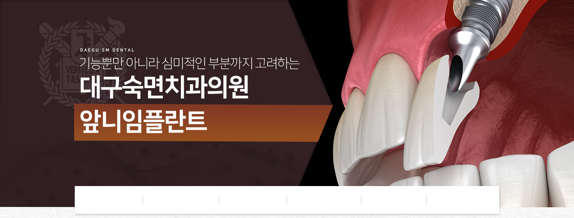 기능뿐만-아니라-심미적인-부분까지-고려하는-대구숙면치과-앞니-임플란트