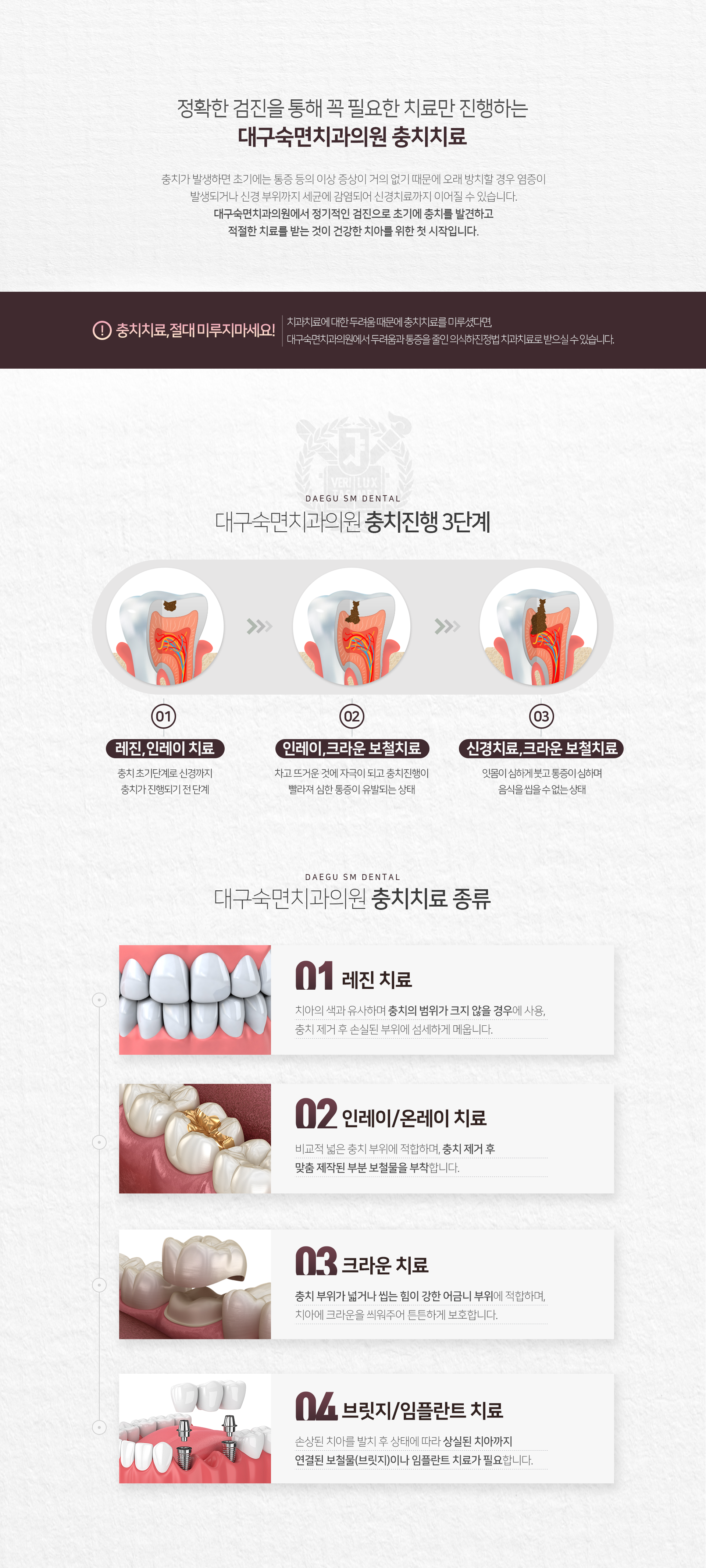 충치치료-종류1-레진-치료-치아의-색과-유사하며-충치의-범위가-크지-않을-경우에-사용-충치-제거-후-손실된-부위에-섬세하게-메웁니다-종류2-인레이-온레이-치료-비교적-넓은-충치-부위에-적합하며-충치-제거-후-맞춤-제작된-부분-보철물을-부착합니다-종류3-크라운-치료-충치-부위가-넓거나-씹는-힘이-강한-어금니-부위에-적합하며-치아에-크라운을-씌워주어-튼튼하게-보호합니다-종류4-브릿지-임플란트-치료-손상된-치아를-발치-후-상태에-따라-상실된-치아까지-연결된-보철물_브릿지이나-임플란트-치료가-필요합니다