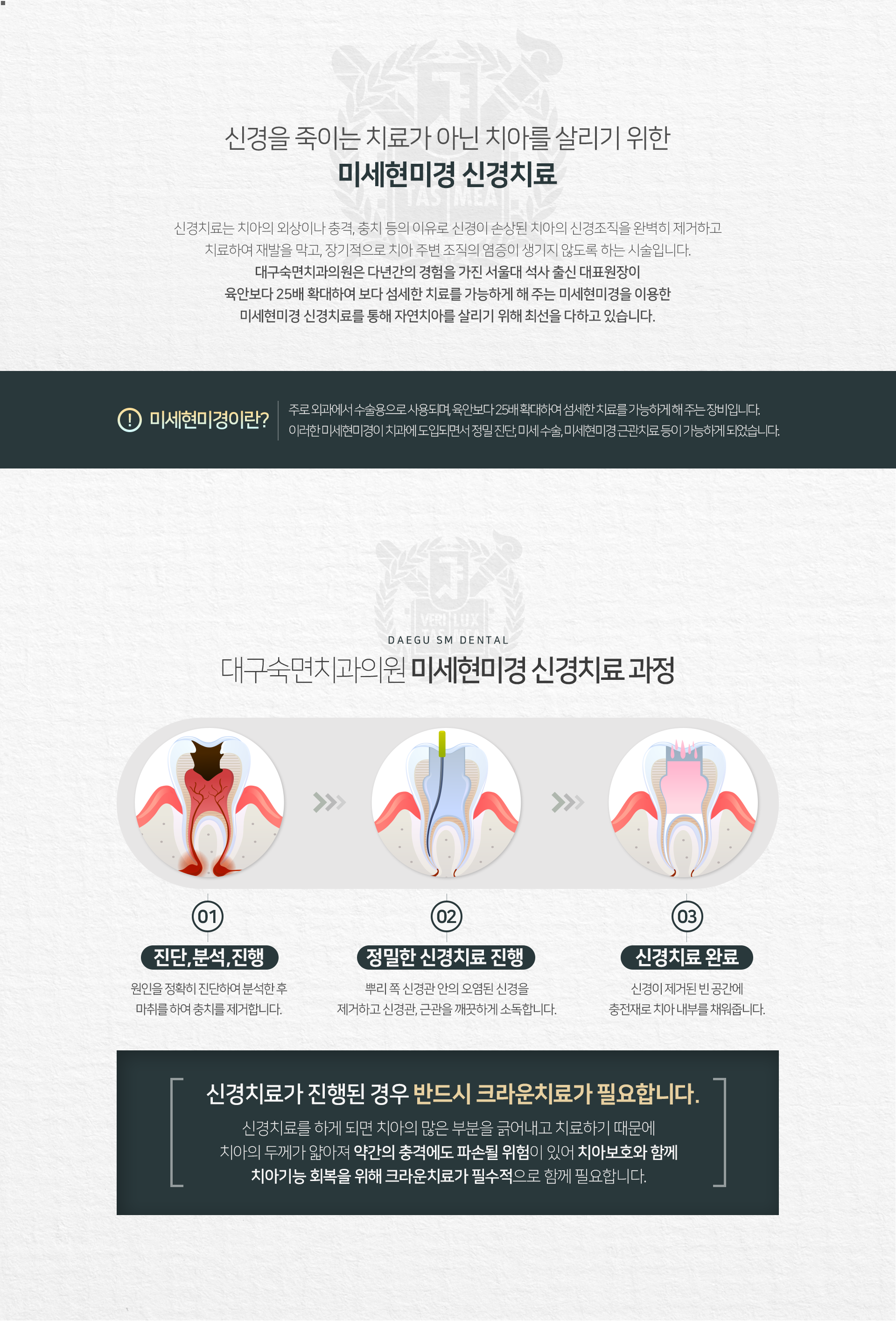 신경이-손상된-치아의-신경조직을-완벽히-제거하고-치료하여-재발을-막고-장기적으로-치아-주변-조직에-염증이-생기지-않도록-하는-시술입니다-신경치료-과정-1단계-원인을-정확히-진단하여-분석한-후-마취를-하여-충치를-제거합니다-2단계-뿌리-쪽-신경관-안의-오염된-신경을-제거하고-신경관-근관을-깨끗하게-소독합니다-3단계-신경이-제거된-빈-공간에-충전재로-치아-내부를-채워줍니다-신경치료가-진행된-경우-반드시-크라운-치료가-필요합니다