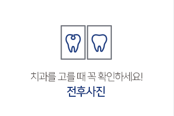 전후사진