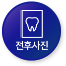 전후사진